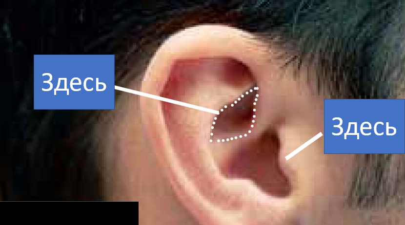 Стимуляций блуждающего нерва через ухо